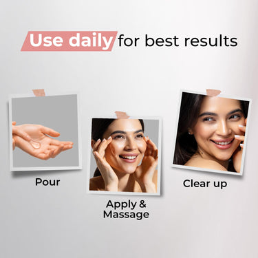 Kaya Clinic 10% Niacinamide + 1% Azeloglycina Face Serum, Dark Spot Corrector, Fights Acne For Unisex Of All Skin Type, 30ml